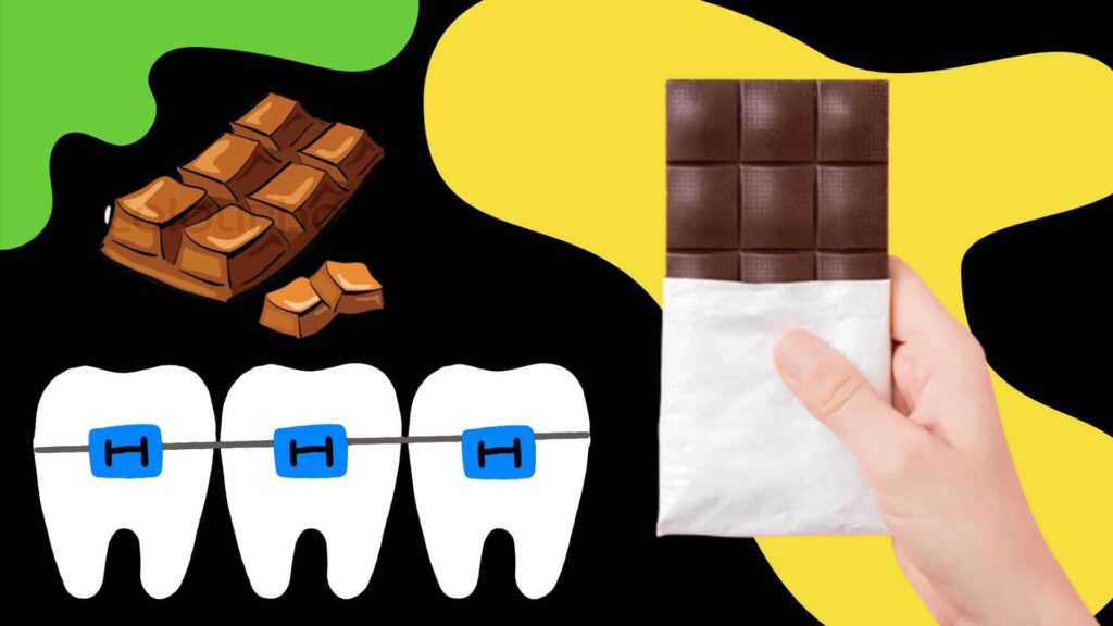 Can You Eat Chocolate With Braces?